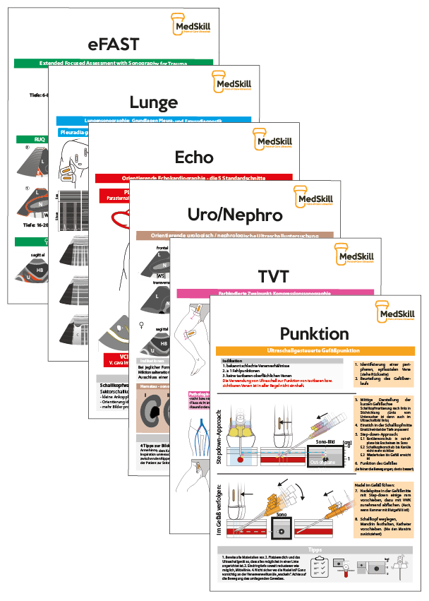 PoCUS Taschenkarten Set