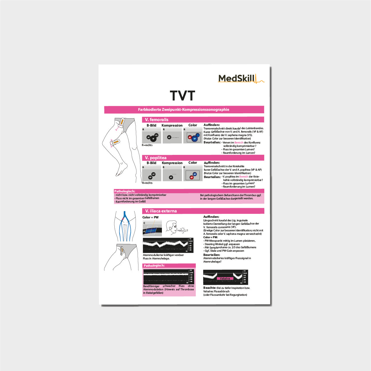 TVT Taschenkarte