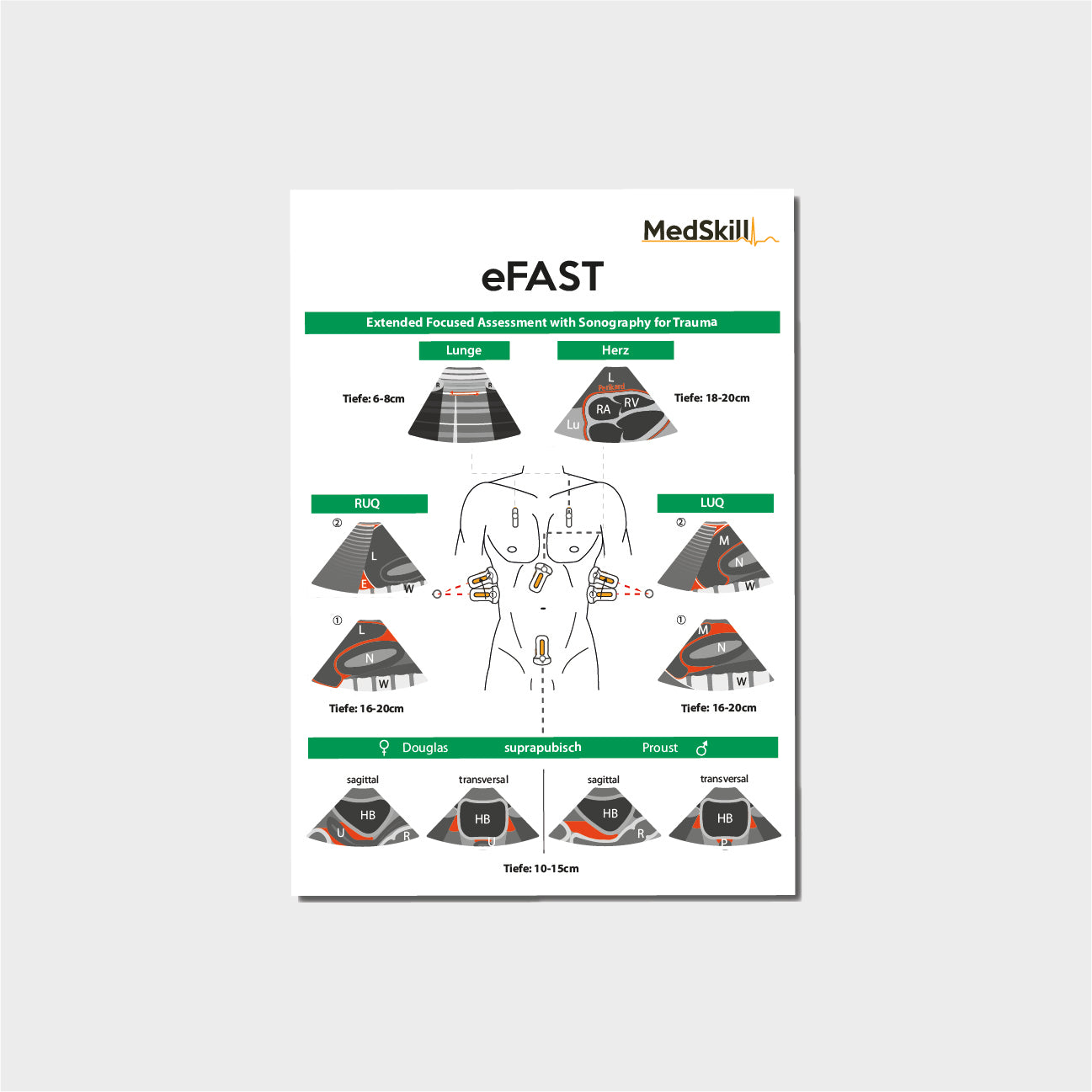 eFAST Taschenkarte